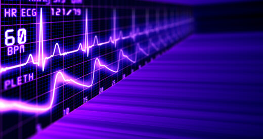 An EKG showing a heart rhythm