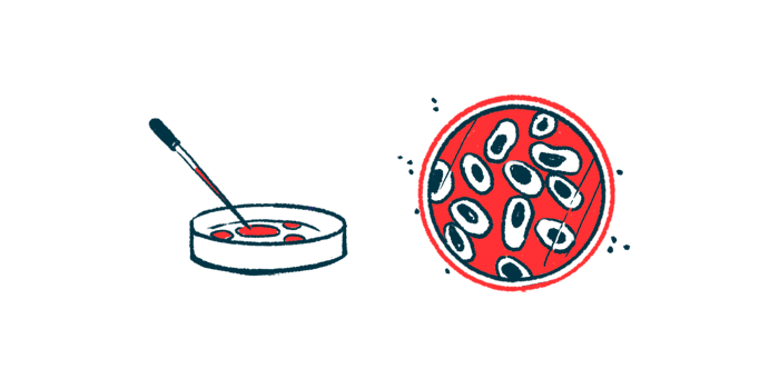 histone deacetylase inhibitors | Friedreich's Ataxia News | illustration of cells in petri dish