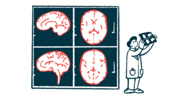 A researcher holds up an image of a brain scan, which is shown enlarged on the wall behind him.