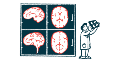 A researcher holds up an image of a brain scan, which is shown enlarged on the wall behind him.