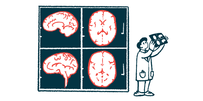 A researcher holds up an image of a brain scan, which is shown enlarged on the wall behind him.