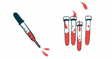 An eyedropper hovers next to four vials partially filled with red fluid.