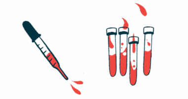 An eyedropper hovers next to four vials partially filled with red fluid.