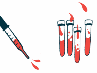 An eyedropper hovers next to four vials partially filled with red fluid.