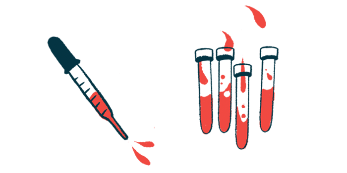 An eyedropper hovers next to four vials partially filled with red fluid.
