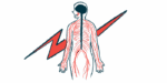 The nerves in the human body are shown in the figure of a person, seen from behind, standing in front of a giant red lightning bolt.