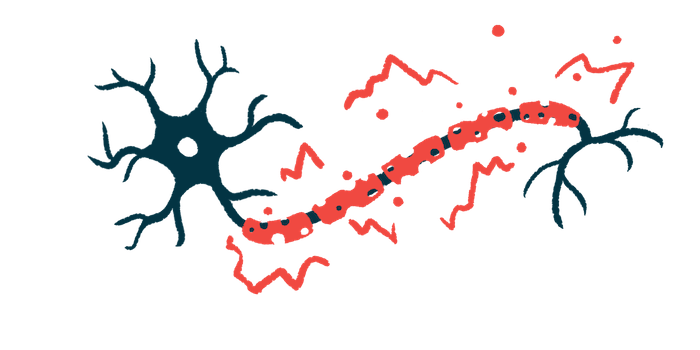 Illustration of a nerve cell and a segmented peripheral nerve, with red highlights suggesting nerve changes or damage.